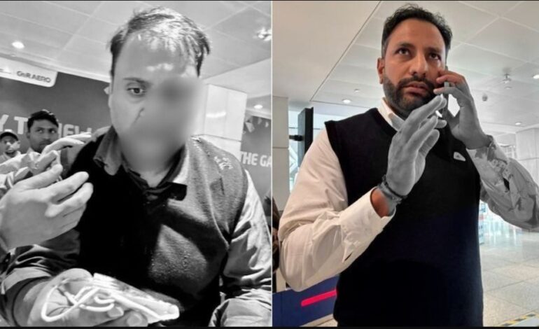 ਯਾਤਰੀ ਨਾਲ ਕੁੱਟਮਾਰ ਕਰਨ ਦੇ ਦੋਸ਼ ਵਿੱਚ ਏਅਰ ਇੰਡੀਆ ਐਕਸਪ੍ਰੈਸ ਦਾ ਪਾਇਲਟ ਗ੍ਰਿਫ਼ਤਾਰ