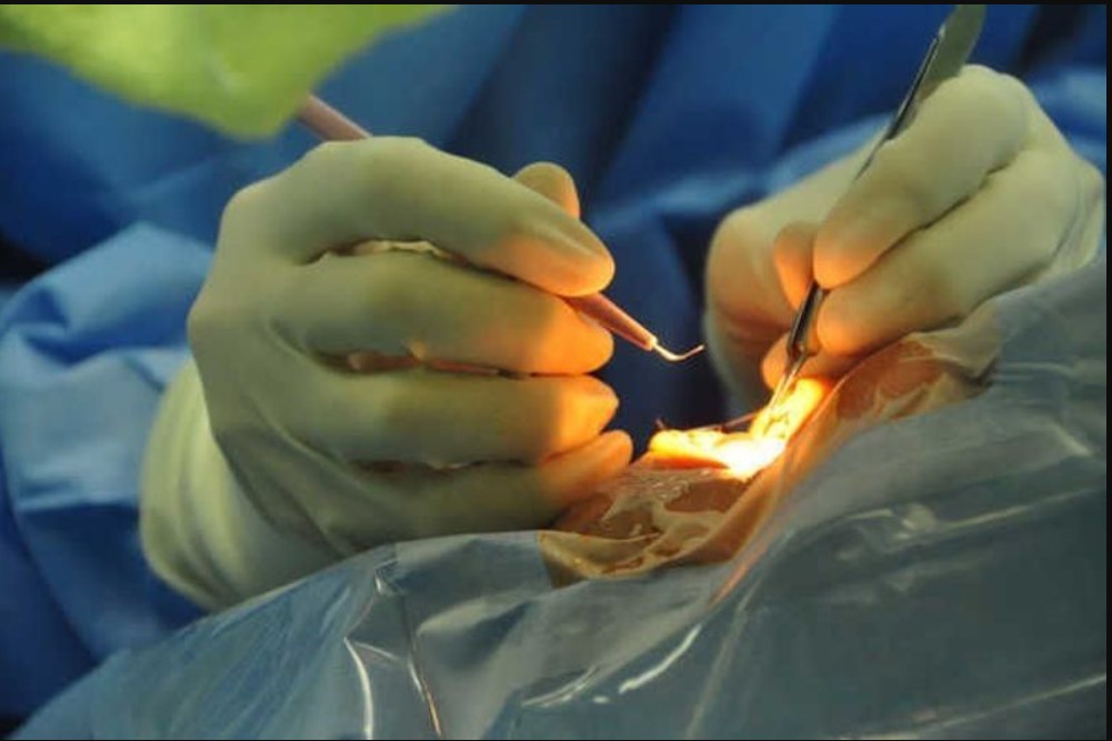 UP: ਅਪ੍ਰੇਸ਼ਨ ਤੋਂ ਬਾਅਦ ਇਨਫੈਕਸ਼ਨ ਕਾਰਨ 9 ਮਰੀਜ਼ਾਂ ਦੀਆਂ ਅੱਖਾਂ ਕੱਢਣੀਆਂ ਪਈਆਂ, 9 ਹੋਰਾਂ ਦੀ ਗਈ ਰੌਸ਼ਨੀ