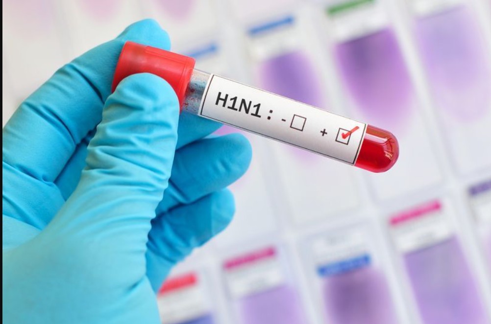 Delhi ’ਚ H1N1 (ਸਵਾਈਨ ਫਲੂ) ਦਾ ਕਹਿਰ: ਨਮੀ ਵਾਲੇ ਮੌਸਮ ਦਰਮਿਆਨ ਵਧੇ ਕੇਸ; ਡਾਕਟਰਾਂ ਵੱਲੋਂ ਚਿਤਾਵਨੀ